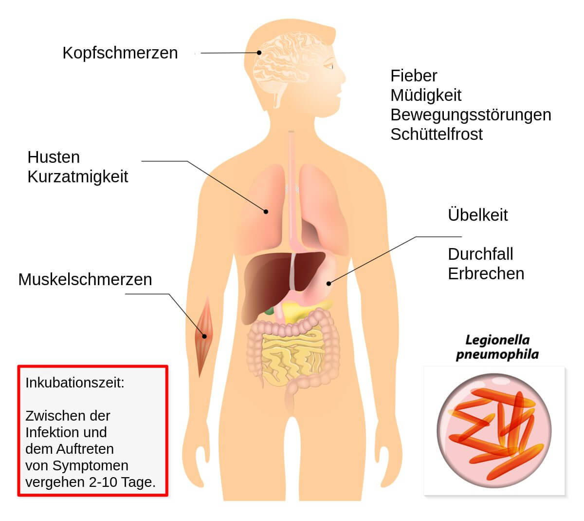 Legionellen Symptome