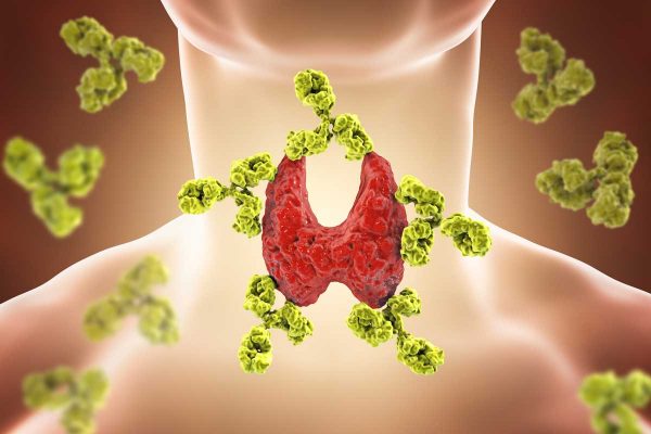 Hashimoto - Antikörper attackieren die Schilddrüse