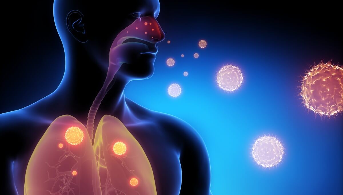 Die Haupteintrittspforten für das Influenza-Virus sind die Schleimhäute der oberen Atemwege 